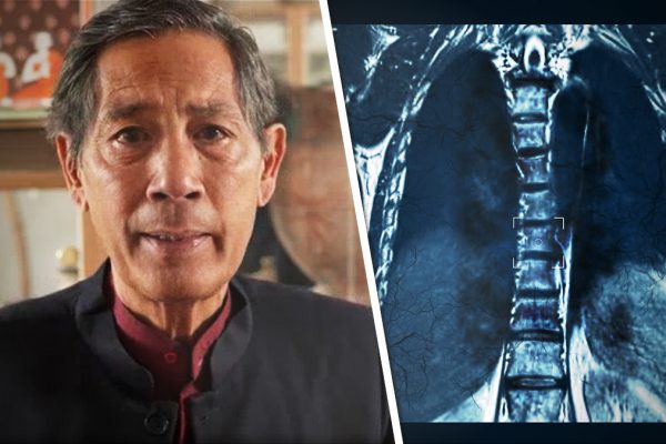 Prof. Bhakdi: Covid-Impfung wird weltweit Anstieg von Tuberkulose und Krebs entfachen