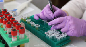 Neue Verordnung: Ende der Massentest-Orgie – Ausnahmen für kostenlose Tests