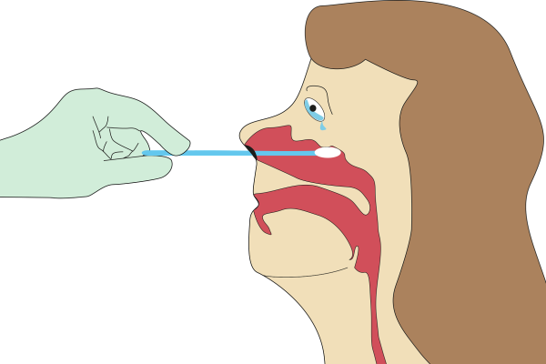 Israels Spitäler haben genug und lehnen PCR-Tests aller Patienten ab